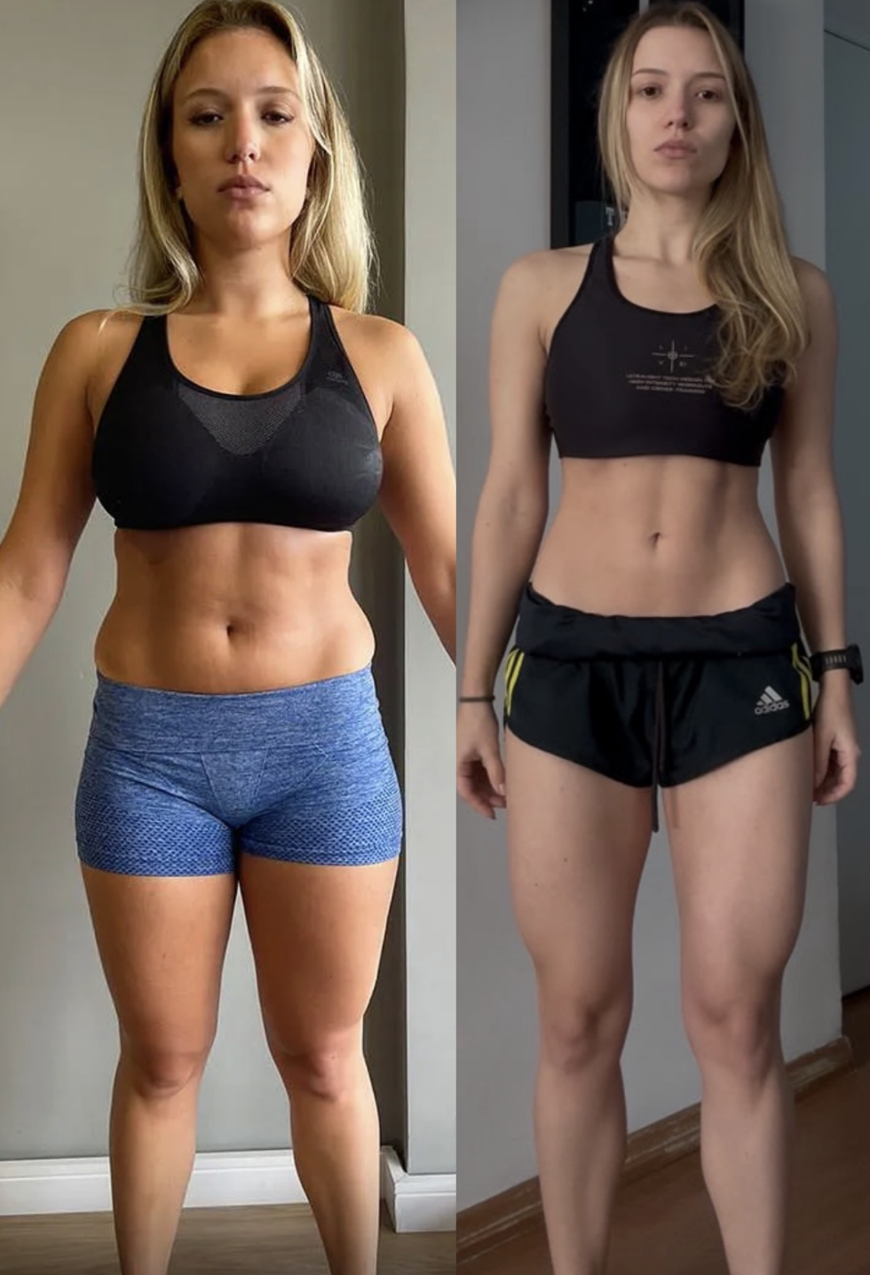 Antes e depois – aluno Letícia Galdoni