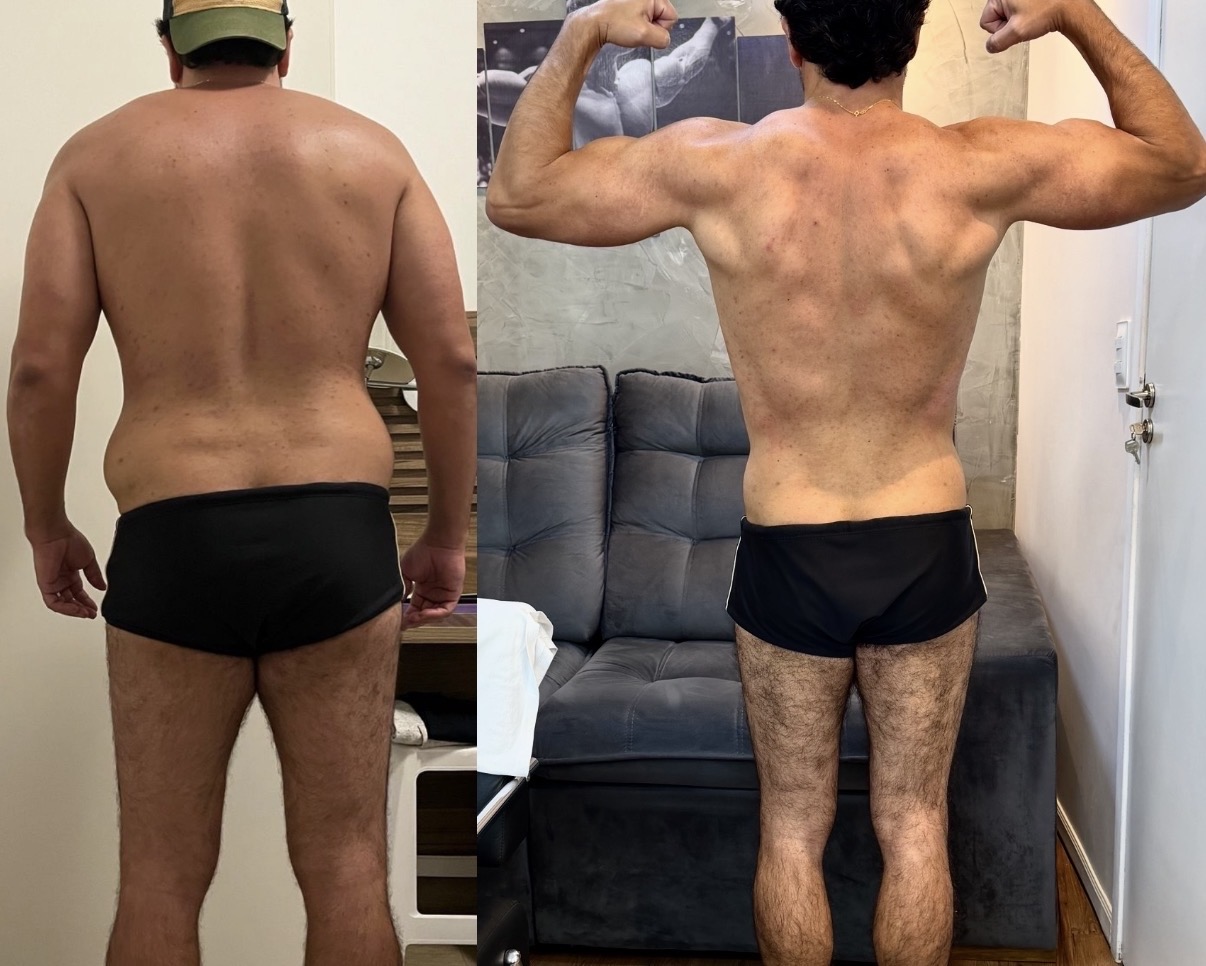 Antes e depois – aluno Lucas Borges