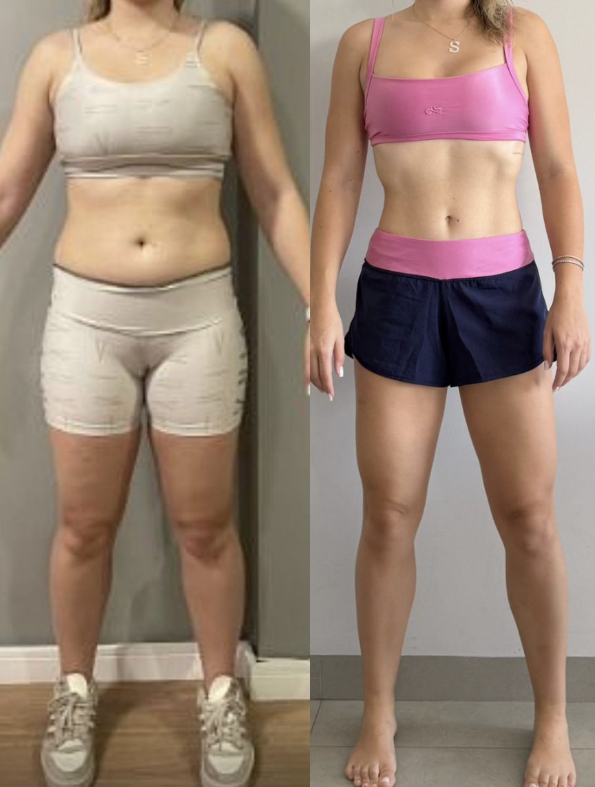Antes e depois – aluno Stefany França